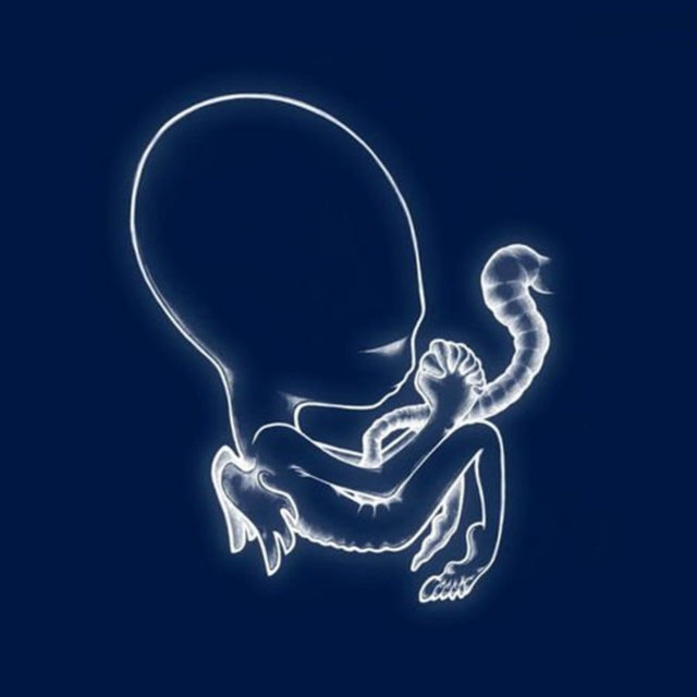 Sigur Ros - Agaetis Byrjun (Vinyl) (US Import)
