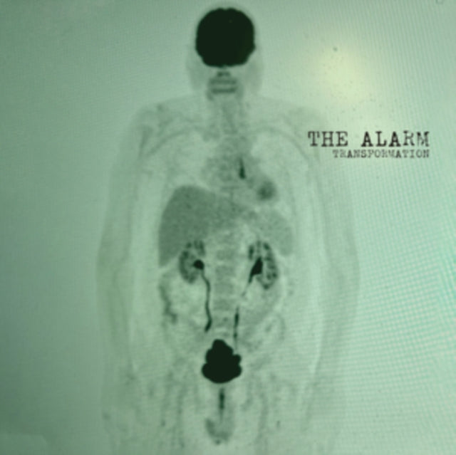Alarm - Transformation (CD)