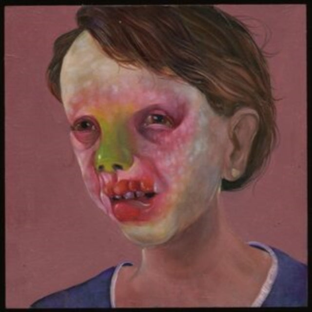Controlled Bleeding - Larva Lumps And Baby Bumps (Gatefold) (Vinyl) (US Import)