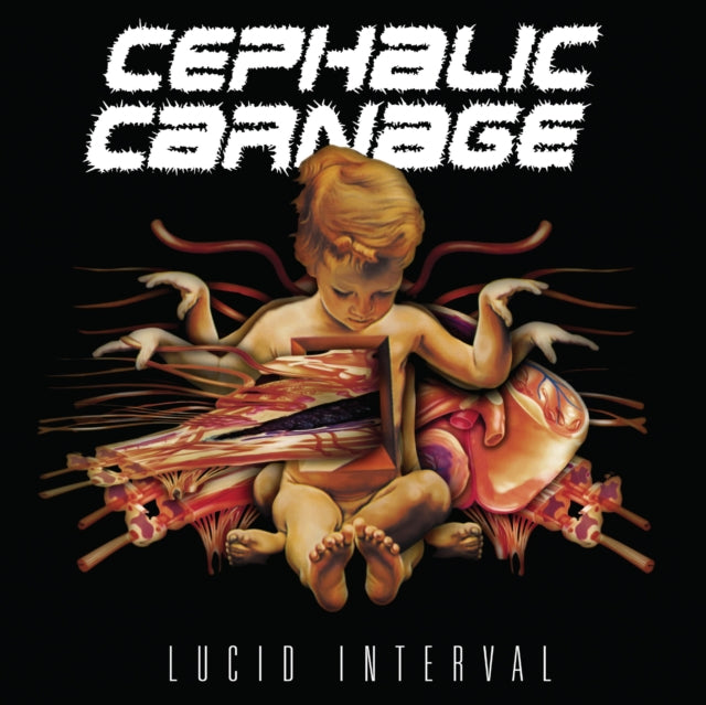 Cephalic Carnage - Lucid Interval (Custom Marble Vinyl) (Vinyl) (US Import)