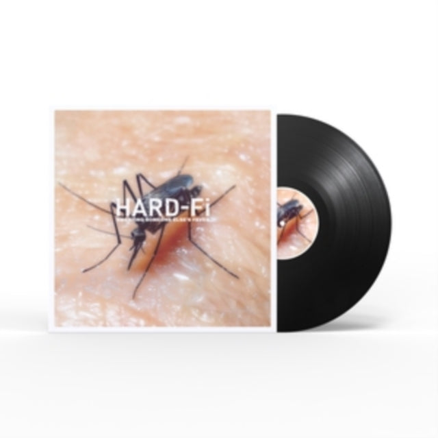Hard-Fi - Sweating Someone Else's Fever (Vinyl) (US Import)